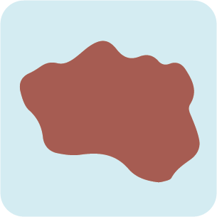 Illustration of a skin lesion